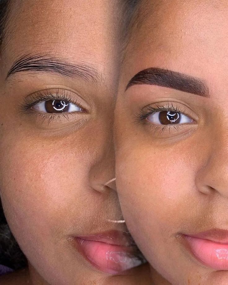 Comparação antes e depois — micropigmentação fio-a-fio
